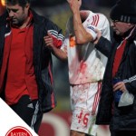 bloody-mess-500x717