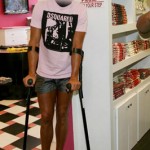 cristiano-ronaldo-burnt-legs-07
